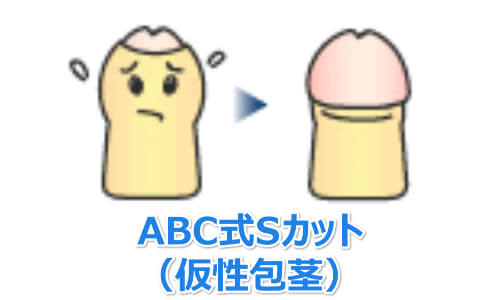 ABC式Sカット