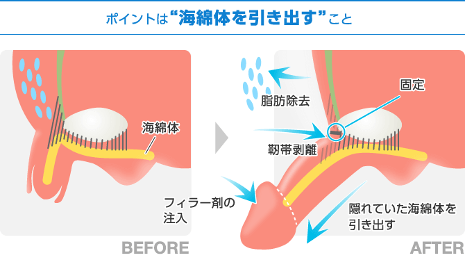 ペニスが痛いと感じる時の具体的な症状と ...