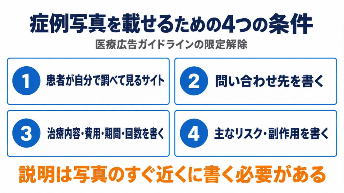 症例写真を載せるための4つの条件(限定解除)
