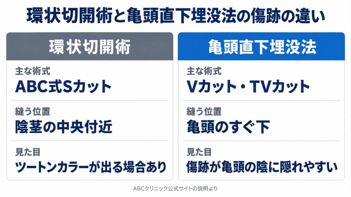 環状切開術と亀頭直下埋没法の傷跡の違い