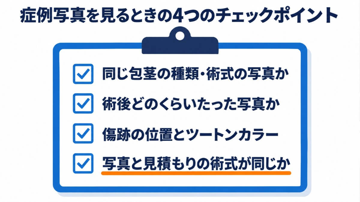 カウンセリングで症例写真を見るときの4つのチェックポイント